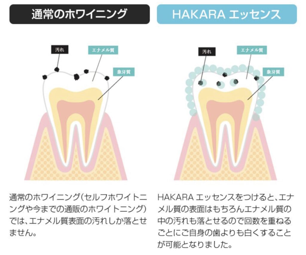 HAKARAが歯を白くするメカニズム